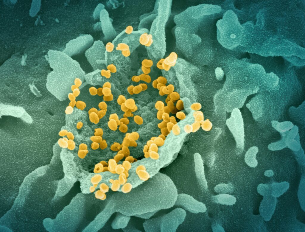 What Do Prokaryotes and Eukaryotes Have in Common? covering shared cell features, genetic information, protein synthesis, metabolism, and biology concepts.